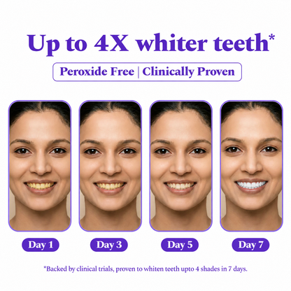 Purple Glow Teeth Whitening Strips